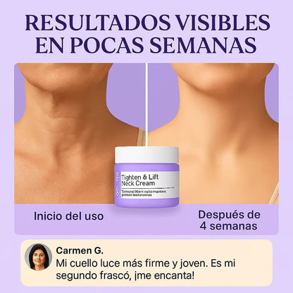 GOPURE™ | Reafirma cuello y brazos sin cirugía.